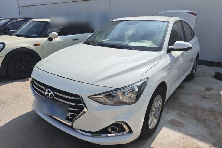 Used Hyundai Celesta 2018 1.6L Automatic GL Enjoyment Edition China VI compliant Guazi used car, China used car export, Used car for sale, Used  cars, Cheapest cars for sale