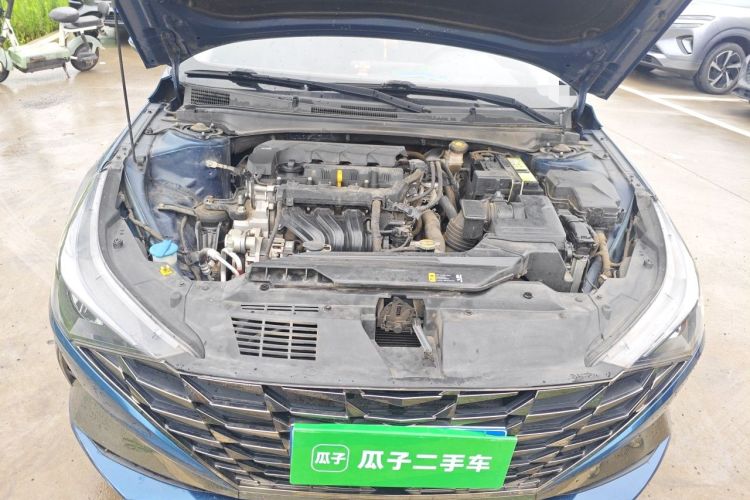 Used Hyundai Elantra 2021 1.5L CVT GLX Elite Edition Engine Bay