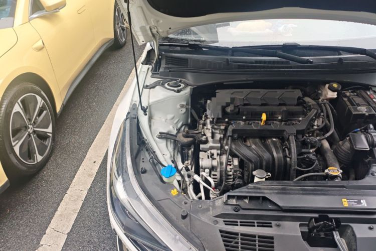 Used Hyundai Elantra 2021 1.5L CVT TOP Flagship Edition Engine Bay Right