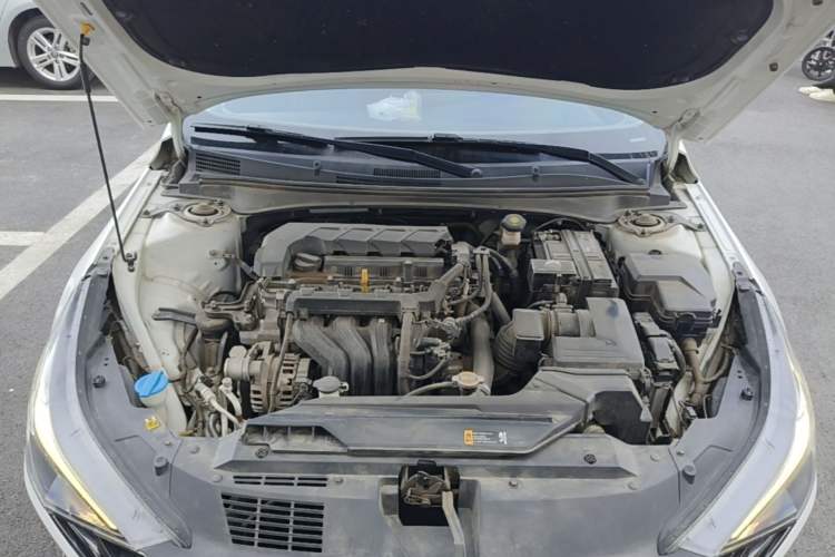 Used Hyundai Elantra 2021 1.5L CVT LUX Prestige Edition Engine Bay