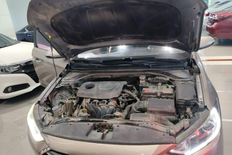 Used Hyundai Elantra (6th Generation / Lingdong) 2016 1.6L Automatic ZhiXuan – Elite Version Engine Bay