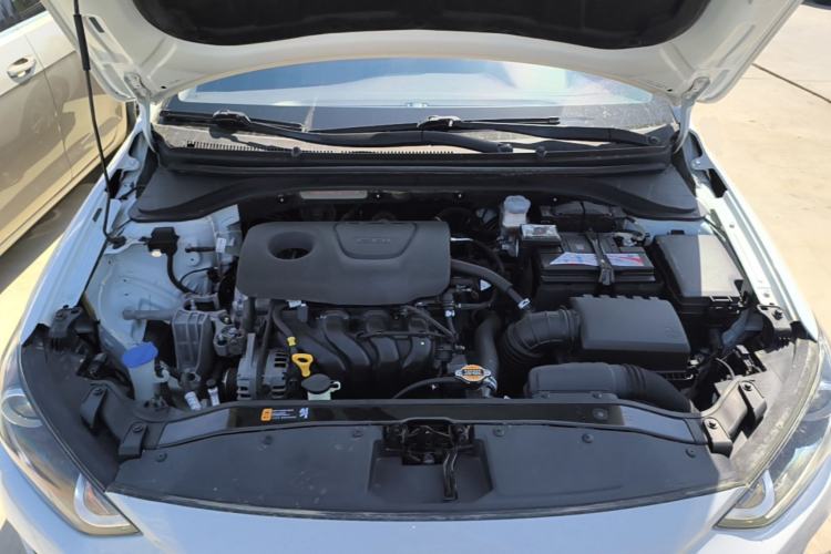 Used Hyundai Elantra (6th Generation / Lingdong) 2016 1.6L Automatic ZhiXuan – Elite Version Engine Bay
