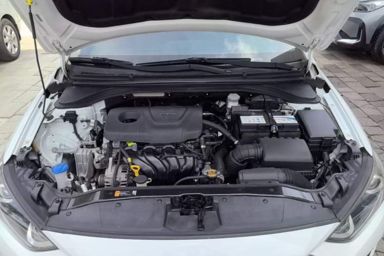 Used Hyundai Elantra (6th Generation / Lingdong) 2016 1.6L Automatic ZhiXuan – Elite Version Engine Bay