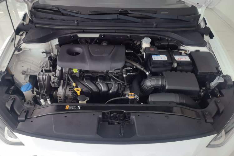 Used Hyundai Elantra (6th Generation / Lingdong) 2016 1.6L Automatic ZhiXuan – Elite Version Engine Bay