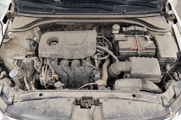 Used Hyundai Elantra (6th Generation / Lingdong) 2016 1.6L Automatic ZhiXuan – Elite Version Engine Bay