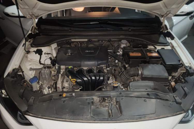 Used Hyundai Elantra (6th Generation / Lingdong) 2016 1.6L Automatic ZhiXuan – Elite Version Engine Bay