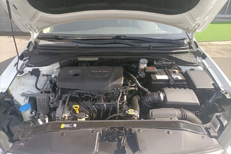 Used Hyundai Elantra (6th Generation / Lingdong) 2016 1.6L Manual ZhiXuan · Dynamic Model Engine Bay