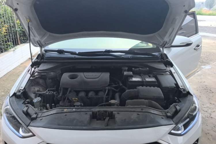 Used Hyundai Elantra (6th Generation / Lingdong) 2016 1.6L Manual ZhiXuan · Dynamic Model Engine Bay