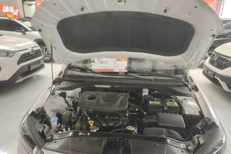 Used Hyundai Elantra (6th Generation / Lingdong) 2016 1.6L Automatic ZhiXuan – Elite Version Engine Bay
