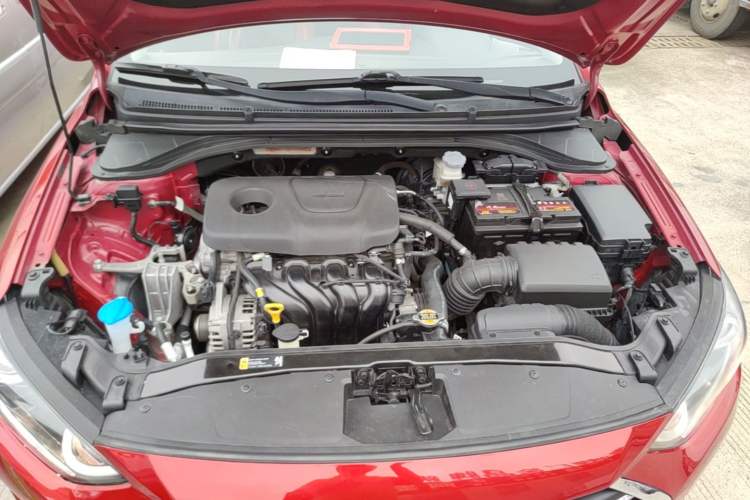 Used Hyundai Elantra (6th Generation / Lingdong) 2018 1.6L Automatic 15th Anniversary Special Edition Engine Bay