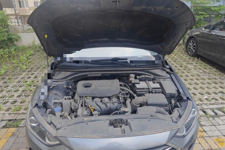 Used Hyundai Elantra (6th Generation / Lingdong) 2018 1.6L Automatic 15th Anniversary Special Edition Engine Bay