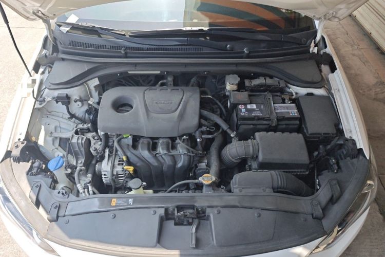 Used Hyundai Elantra (6th Generation / Lingdong) 2018 1.6L Automatic 15th Anniversary Special Edition Engine Bay