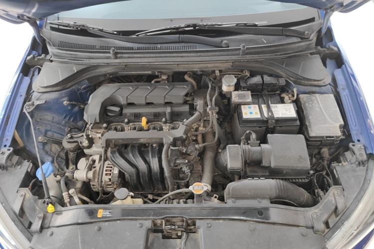 Used Hyundai Elantra (6th Generation / Lingdong) 2019 1.5L CVT ZhiXuan – Elite Version Engine Bay