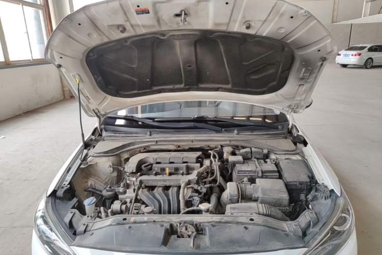 Used Hyundai Elantra (6th Generation / Lingdong) 2019 1.5L CVT ZhiXuan – Elite Version Engine Bay