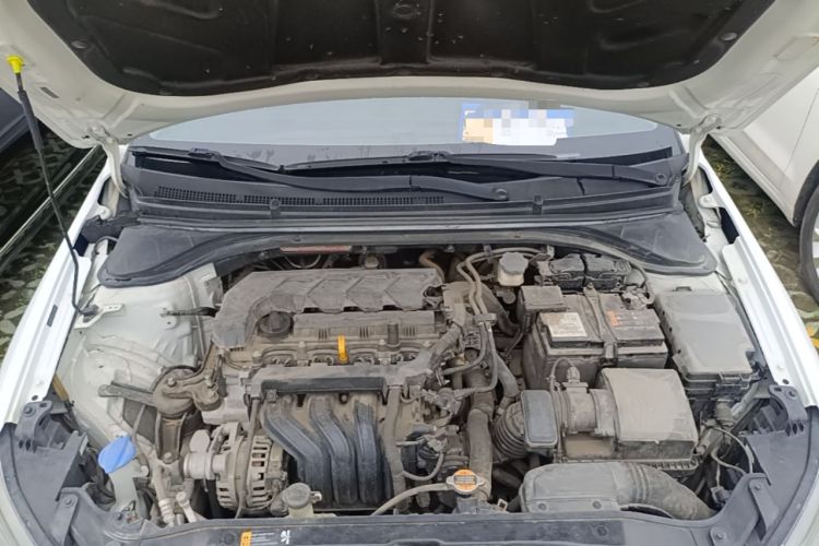 Used Hyundai Elantra (6th Generation / Lingdong) 2019 1.5L CVT ZhiXuan – Elite Version Engine Bay