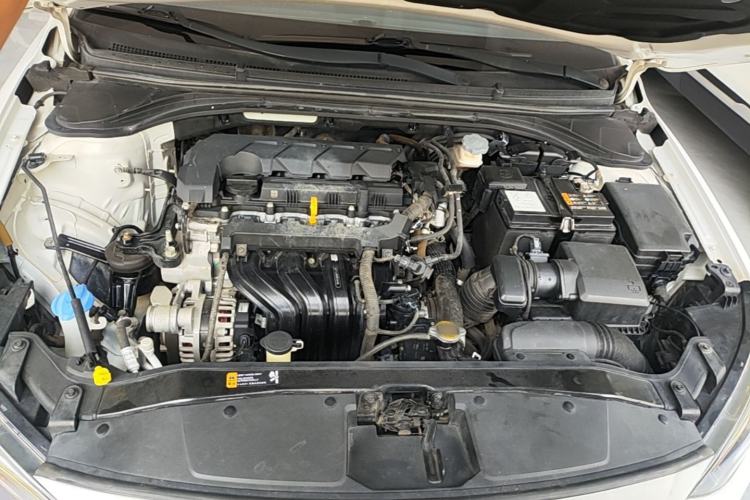 Used Hyundai Elantra (6th Generation / Lingdong) 2019 1.5L CVT ZhiXuan – Elite Version Engine Bay