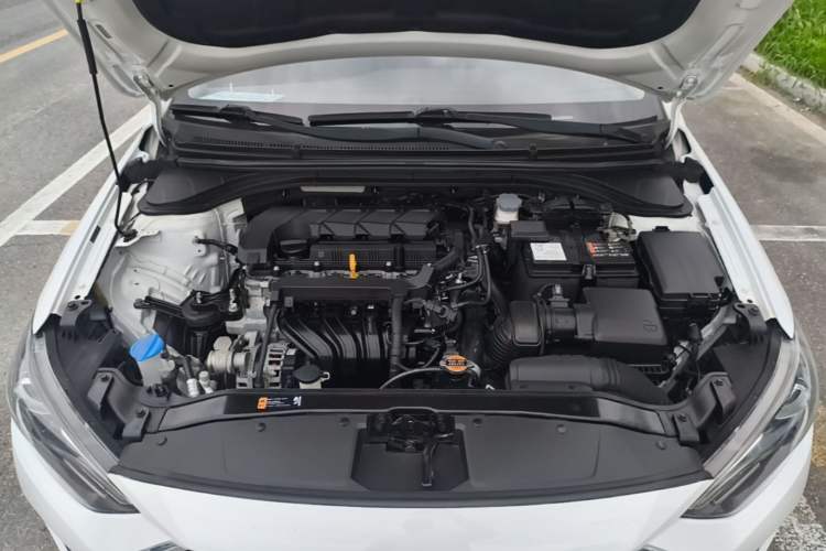 Used Hyundai Elantra (6th Generation / Lingdong) 2019 1.5L CVT ZhiXuan – Elite Version Engine Bay