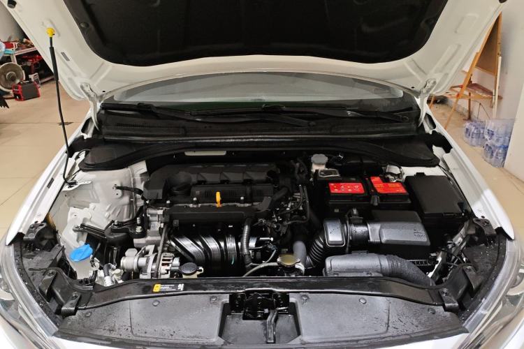 Used Hyundai Elantra (6th Generation / Lingdong) 2019 1.5L CVT ZhiXuan – Elite Version Engine Bay