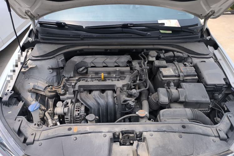 Used Hyundai Elantra (6th Generation / Lingdong) 2019 1.5L CVT ZhiXuan – Elite Version Engine Bay