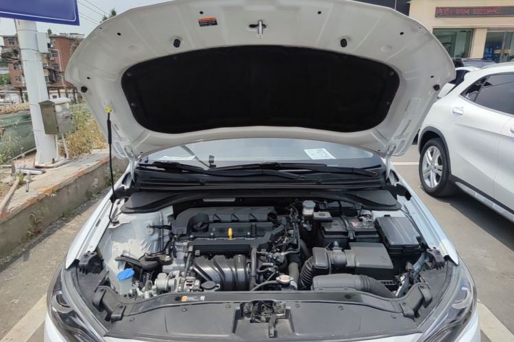 Used Hyundai Elantra (6th Generation / Lingdong) 2019 1.5L CVT ZhiXuan – Elite Version Engine Bay