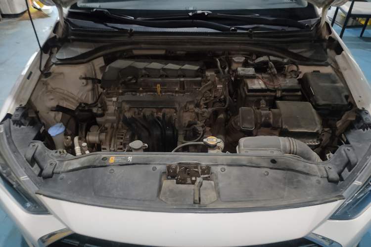 Used Hyundai Elantra (6th Generation / Lingdong) 2019 1.5L CVT ZhiXuan – Elite Version Engine Bay