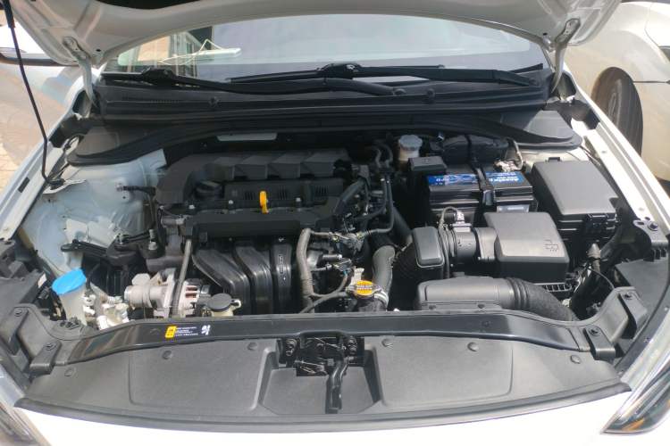 Used Hyundai Elantra (6th Generation / Lingdong) 2019 1.5L CVT ZhiXuan – Elite Version Engine Bay