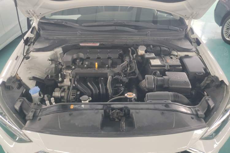 Used Hyundai Elantra (6th Generation / Lingdong) 2019 1.5L CVT ZhiXuan – Elite Version Engine Bay