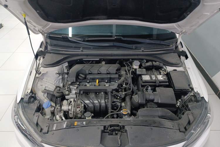 Used Hyundai Elantra (6th Generation / Lingdong) 2019 1.5L CVT ZhiXuan – Elite Version Engine Bay