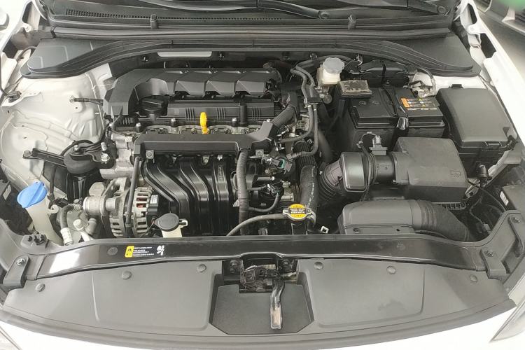 Used Hyundai Elantra (6th Generation / Lingdong) 2019 1.5L CVT ZhiXuan – Elite Version Engine Bay