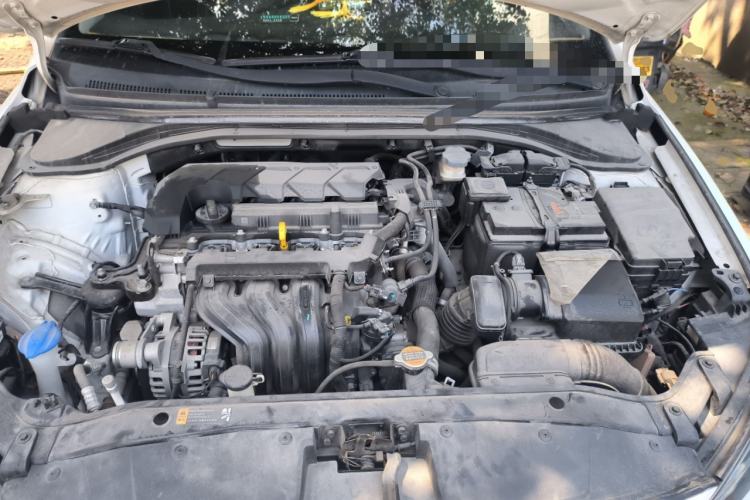 Used Hyundai Elantra (6th Generation / Lingdong) 2019 1.5L CVT ZhiXuan – Elite Version Engine Bay