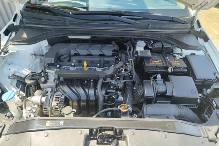 Used Hyundai Elantra (6th Generation / Lingdong) 2019 1.5L CVT ZhiXuan – Elite Version Engine Bay