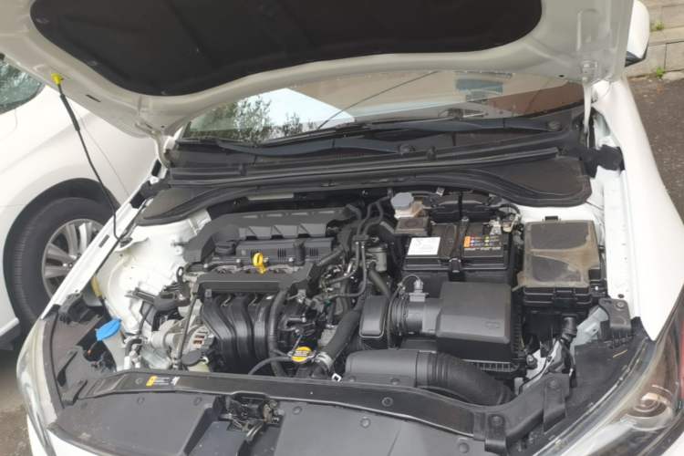 Used Hyundai Elantra (6th Generation / Lingdong) 2019 1.5L CVT ZhiXuan – Elite Version Engine Bay