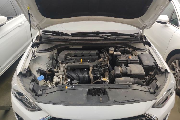 Used Hyundai Elantra (6th Generation / Lingdong) 2019 1.5L CVT ZhiXuan – Elite Version Engine Bay