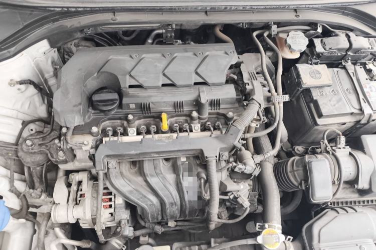Used Hyundai Elantra (6th Generation / Lingdong) 2019 1.5L CVT ZhiXuan – Elite Version Engine Bay