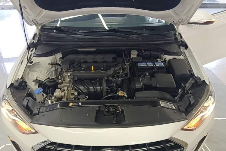 Used Hyundai Elantra (6th Generation / Lingdong) 2019 1.5L CVT ZhiXuan – Elite Version Engine Bay