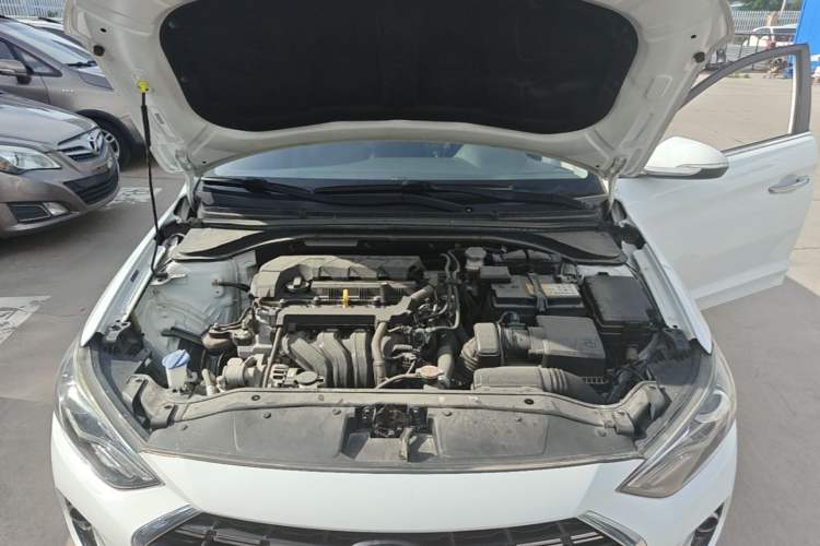 Used Hyundai Elantra (6th Generation / Lingdong) 2019 1.5L CVT ZhiXuan – Elite Version Engine Bay