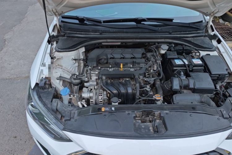Used Hyundai Elantra (6th Generation / Lingdong) 2019 1.5L CVT ZhiXuan – Elite Version Engine Bay Right