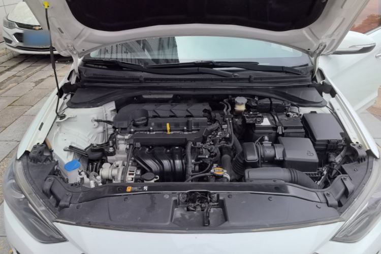 Used Hyundai Elantra (6th Generation / Lingdong) 2019 1.5L CVT ZhiXuan – Elite Version Engine Bay