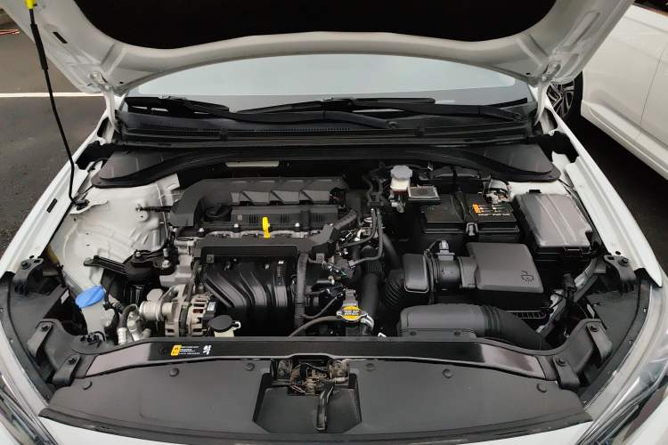 Used Hyundai Elantra (6th Generation / Lingdong) 2019 1.5L CVT ZhiXuan – Elite Version Engine Bay