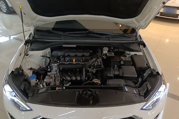 Used Hyundai Elantra (6th Generation / Lingdong) 2019 1.5L CVT ZhiXuan – Elite Version Engine Bay