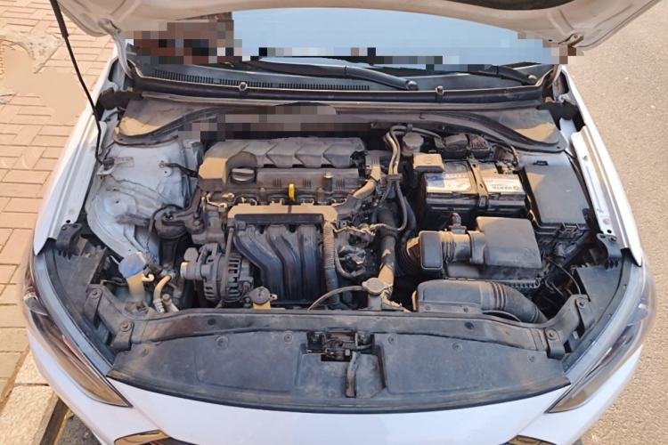 Used Hyundai Elantra (6th Generation / Lingdong) 2019 1.5L CVT ZhiXuan – Elite Version Engine Bay