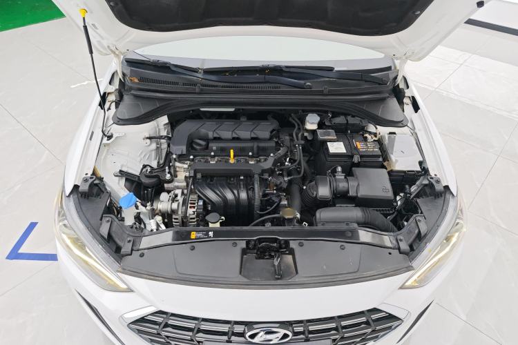 Used Hyundai Elantra (6th Generation / Lingdong) 2019 1.5L CVT ZhiXuan – Elite Version Engine Bay