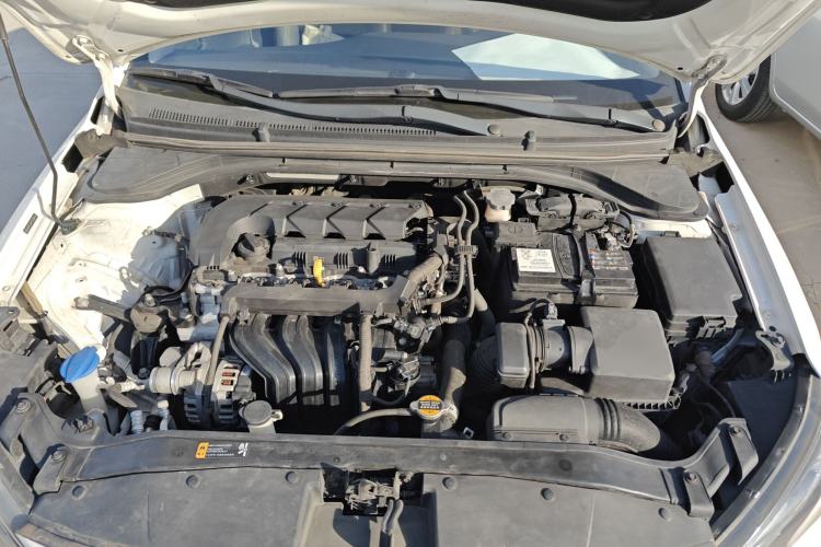Used Hyundai Elantra (6th Generation / Lingdong) 2019 1.5L CVT ZhiXuan – Elite Version Engine Bay