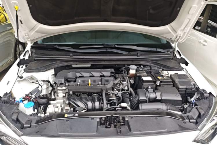 Used Hyundai Elantra (6th Generation / Lingdong) 2019 1.5L CVT ZhiXuan – Elite Version Engine Bay