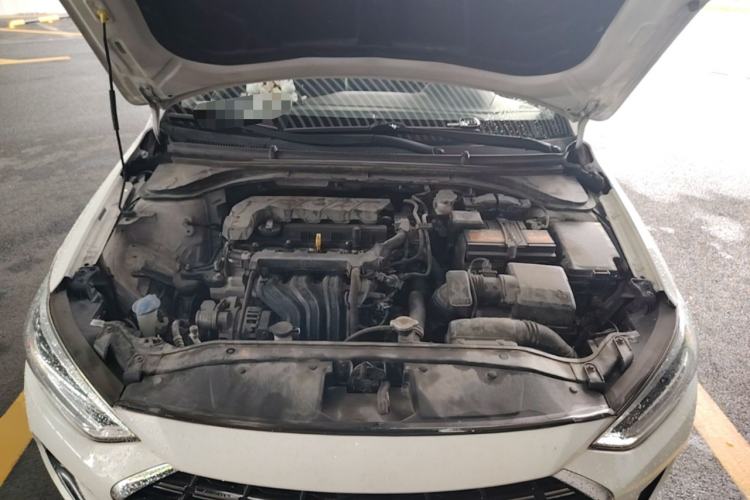 Used Hyundai Elantra (6th Generation / Lingdong) 2019 1.5L CVT ZhiXuan – Elite Version Engine Bay