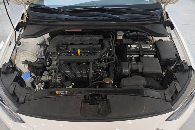 Used Hyundai Elantra (6th Generation / Lingdong) 2019 1.5L CVT ZhiXuan – Elite Version Engine Bay