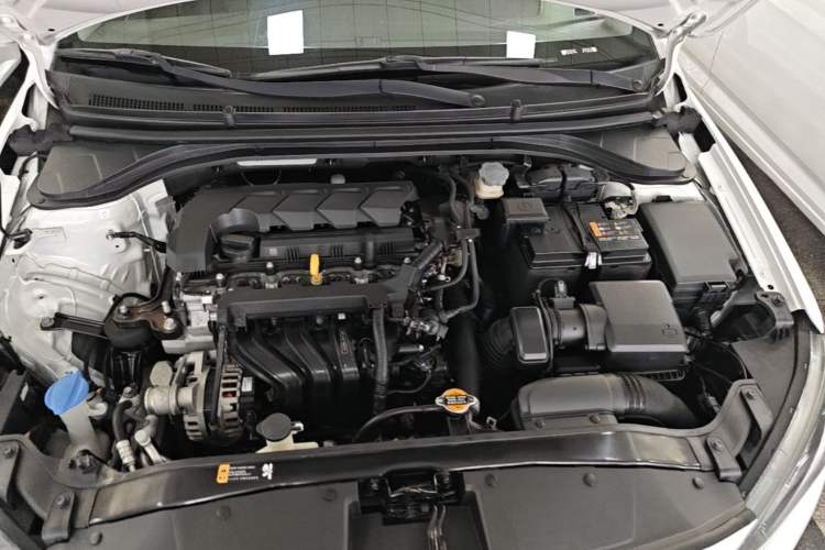 Used Hyundai Elantra (6th Generation / Lingdong) 2019 1.5L CVT ZhiXuan – Elite Version Engine Bay