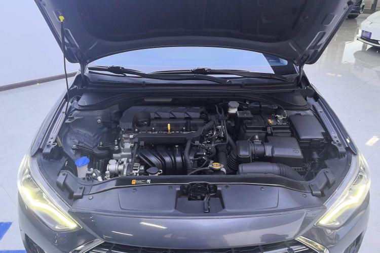 Used Hyundai Elantra (6th Generation / Lingdong) 2020 1.5L CVT Smart & Stylish – Elite Version Engine Bay