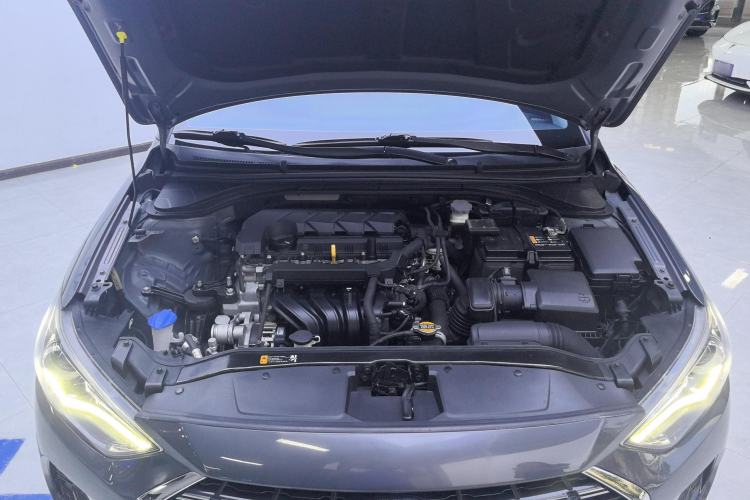 Used Hyundai Elantra (6th Generation / Lingdong) 2020 1.5L CVT Smart & Stylish – Elite Version Engine Bay