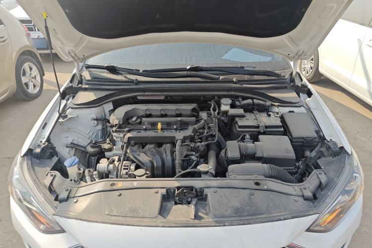 Used Hyundai Elantra (6th Generation / Lingdong) 2020 1.5L CVT Smart & Stylish – Elite Version Engine Bay